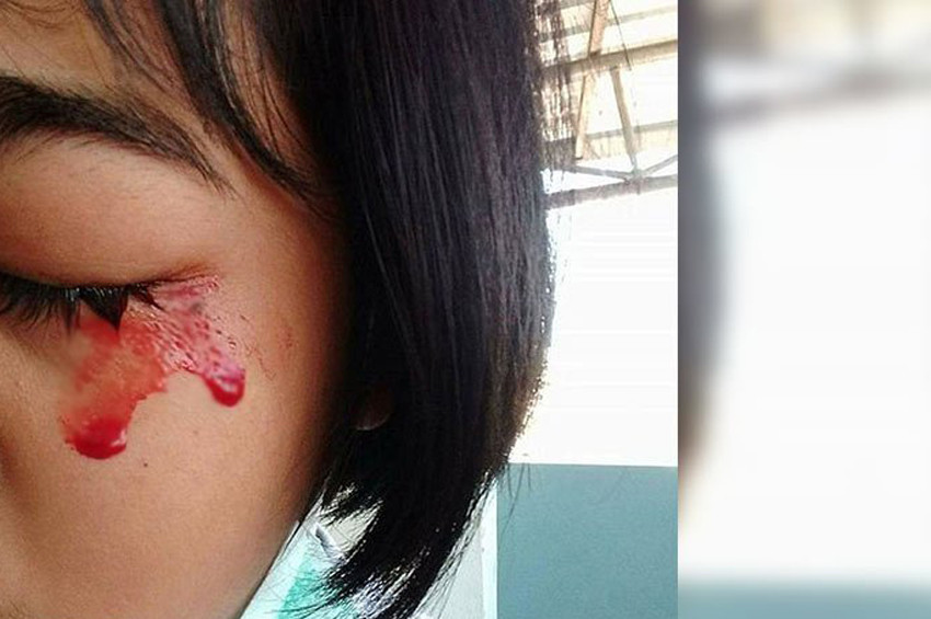 Kan terleyen İtalyan genç kız