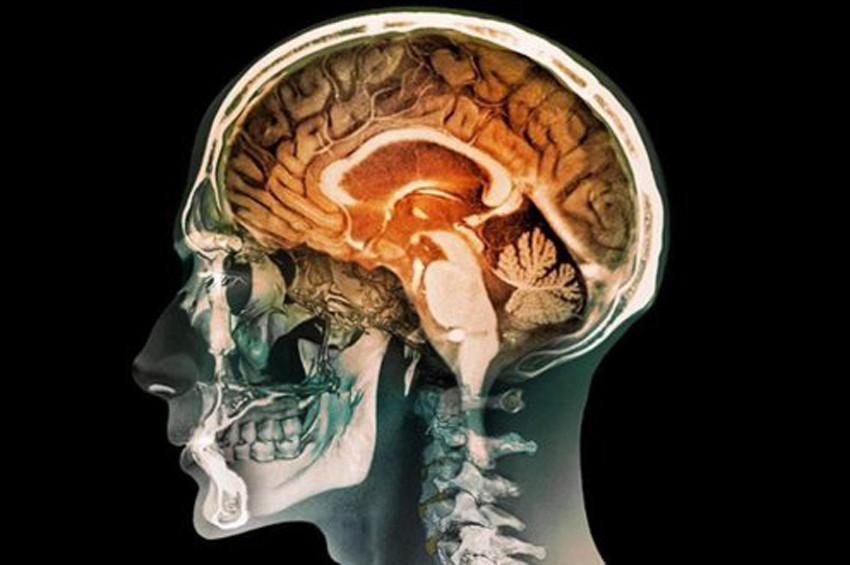 Yapay minyatür insan beyni üretildi!