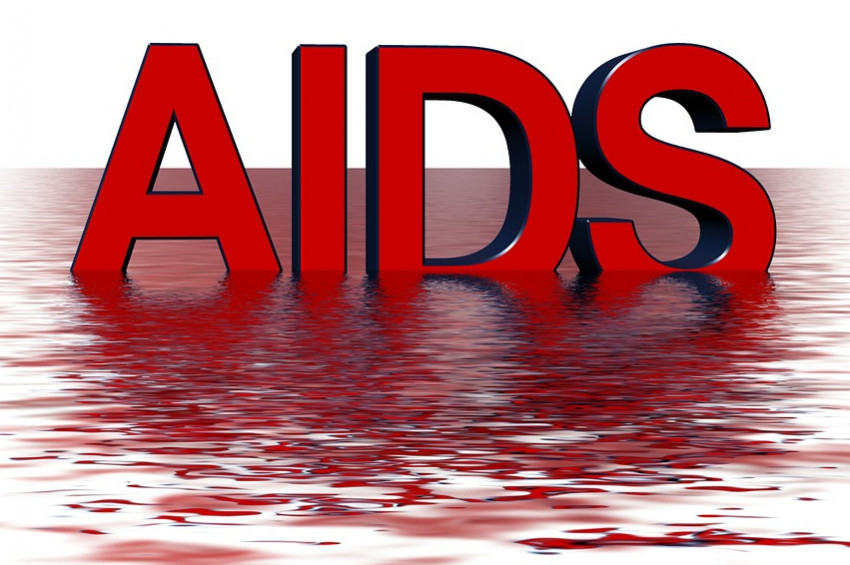Türlkiyede AIDS vakası arttı