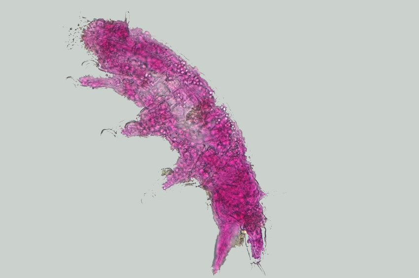 Türkiyede mikroskobik yeni canlı türü tespit edildi