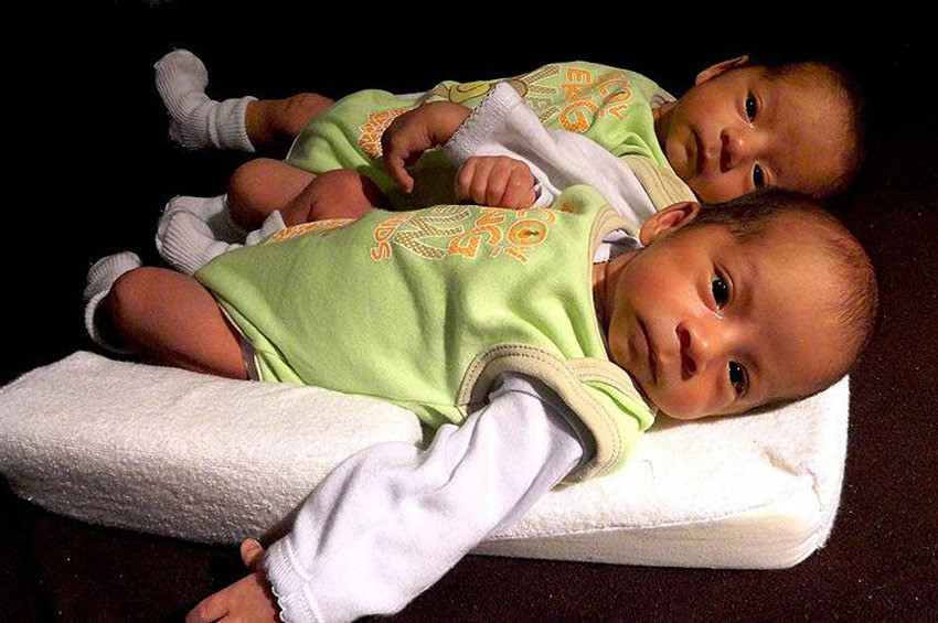 Tek yumurta ikizleri moleküleri de benzer