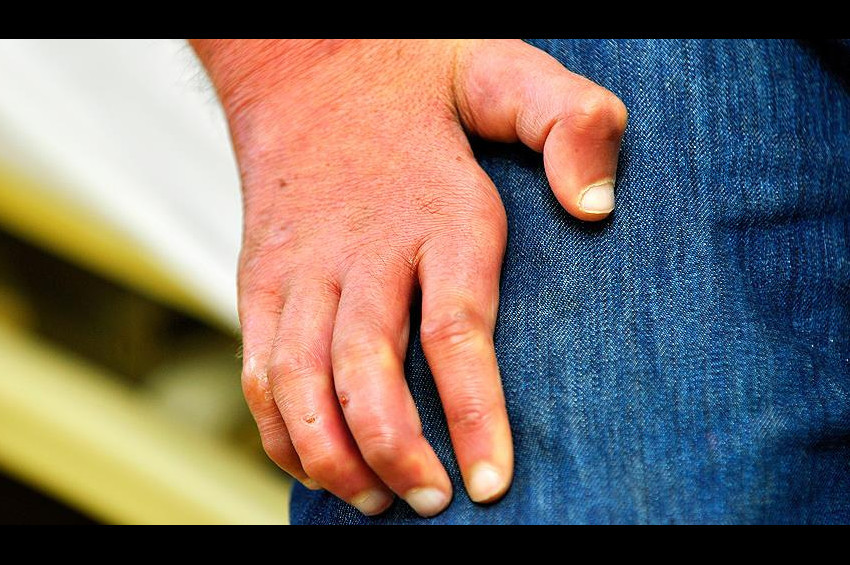 Tarih boyu en korkutucu hastalık: Cüzzam