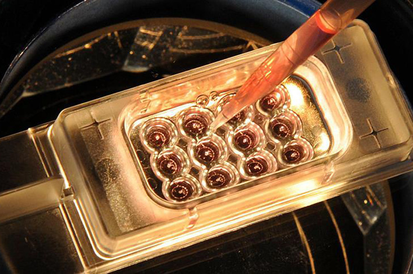 Laboratuvarda insan yumurtası geliştirildi