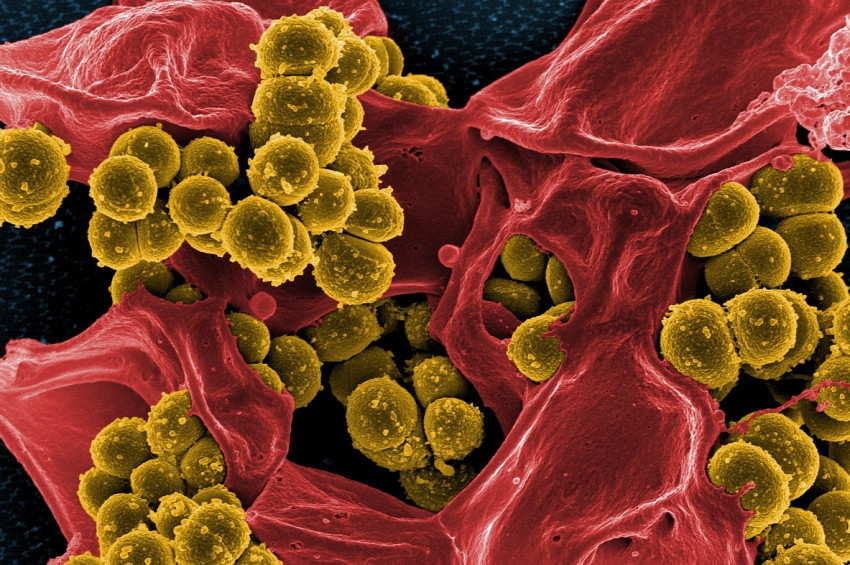 Alzaymırı önleyebilecek Trem2 hücresi keşfedildi