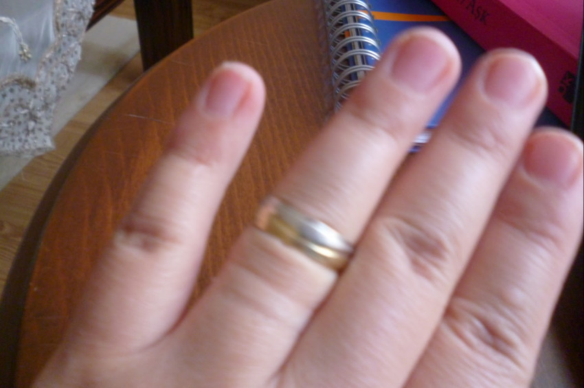 Ödeme karşı 5 tavsiye