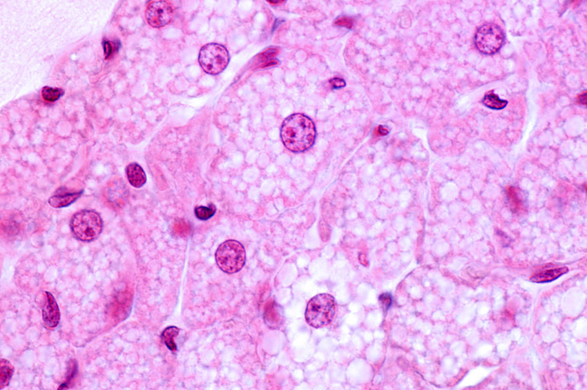 Metabolik muhafız: Nrf1 molekülü