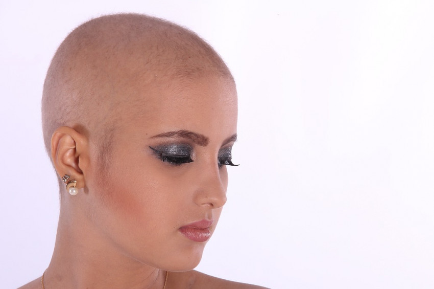 Radyoterapi görenler, radyasyon yaymıyor