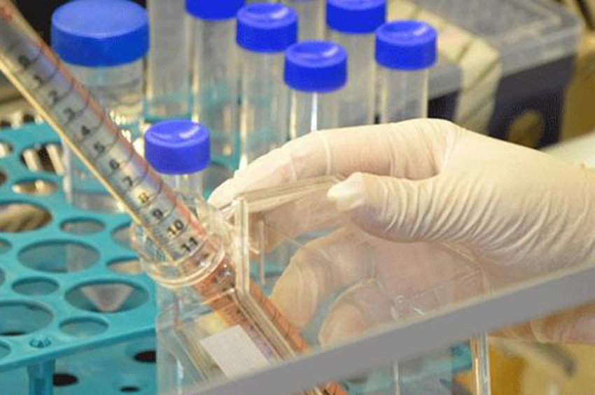 Bağımlılığa karşı yerli antikor üretildi