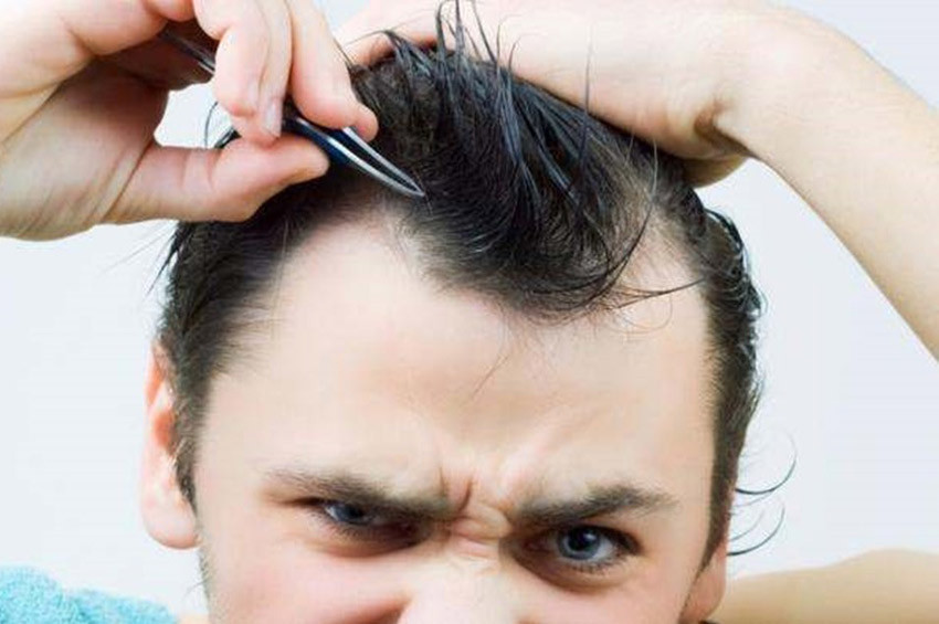 Tikotilomani: Saç ve kıl koparma hastalığı