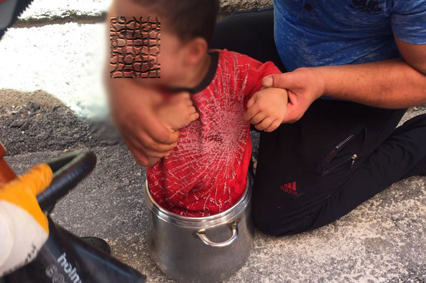 Çorumda tencereye sıkışan çocuğu itfaiye kurtardı