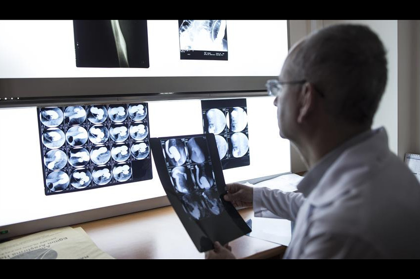 Renkli ve 3 boyutlu röntgen ilk kez insan üzerinde denendi