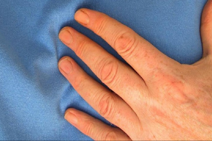 Kalp hastalarına bayram uyarısı