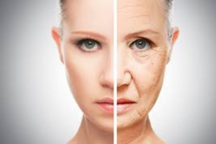 Göz çevresindeki kırışıklıklara karşı 4 ipucu