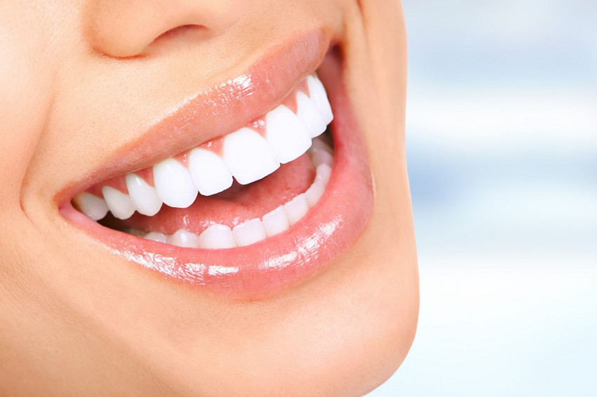 Dişleri beyazlatmatmak için ne yapmalı, ne yapmamalı?
