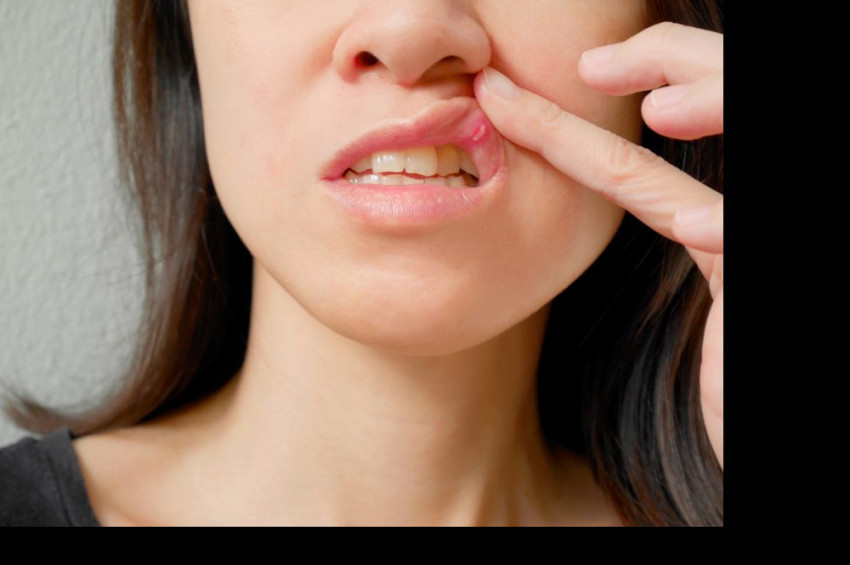 Bağışıklık sisteminin zayıfladığını gösteren 4 sinyal