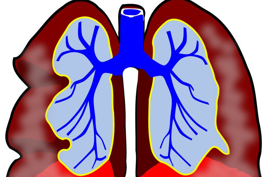 Astım hastaları mecbur kalmadıkça evden çıkmamalı