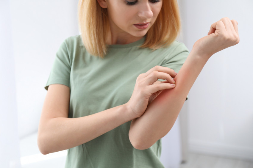 Yazın sakınılması gereken 6 alerji