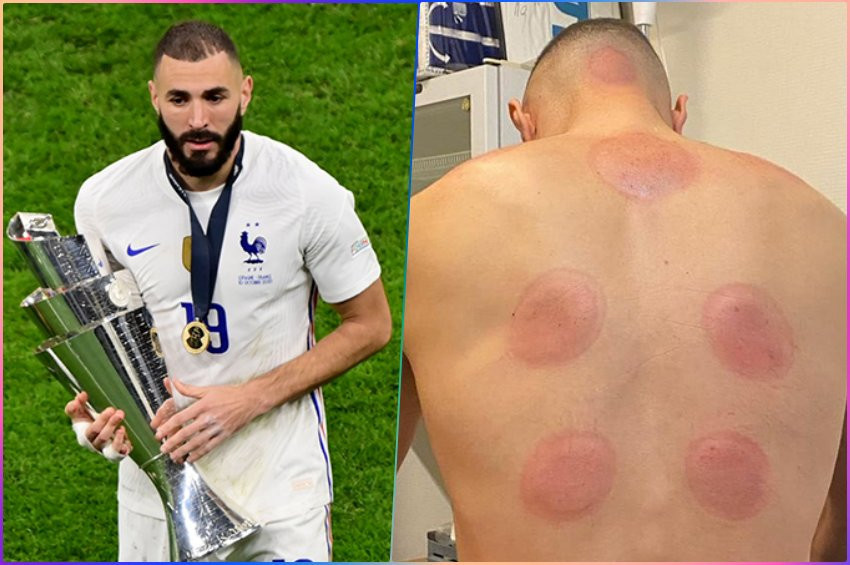 Benzema: En iyi terapi hacamat