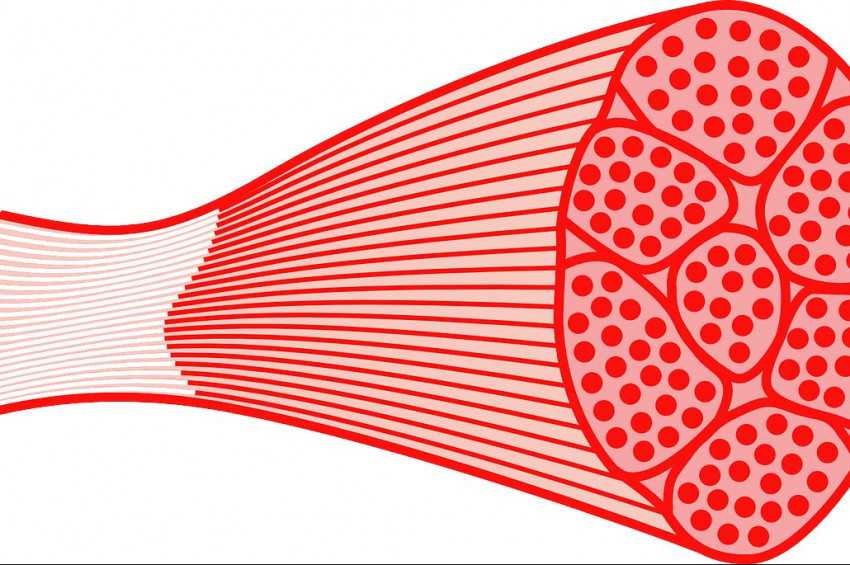 Kas yırtılması nedir, nasıl tedavi edilir?