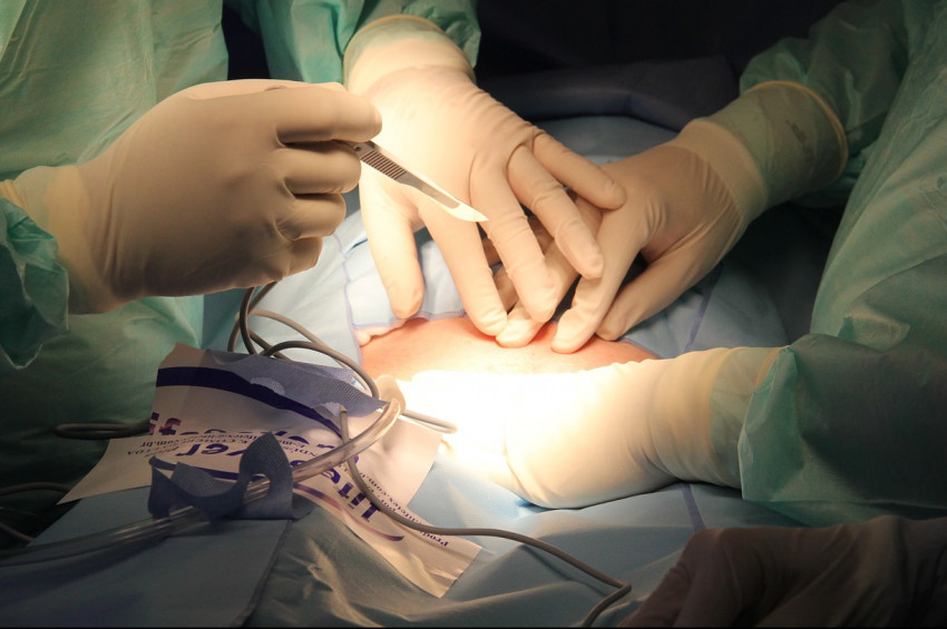 Domuz böbreği İnsana nakledildi