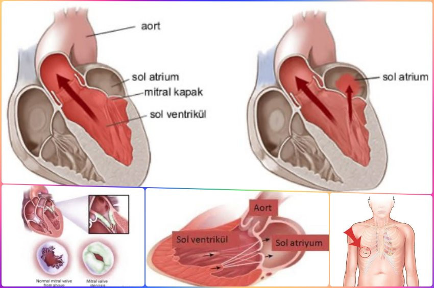 Kalpteki mitral kapak ne işe yarar?
