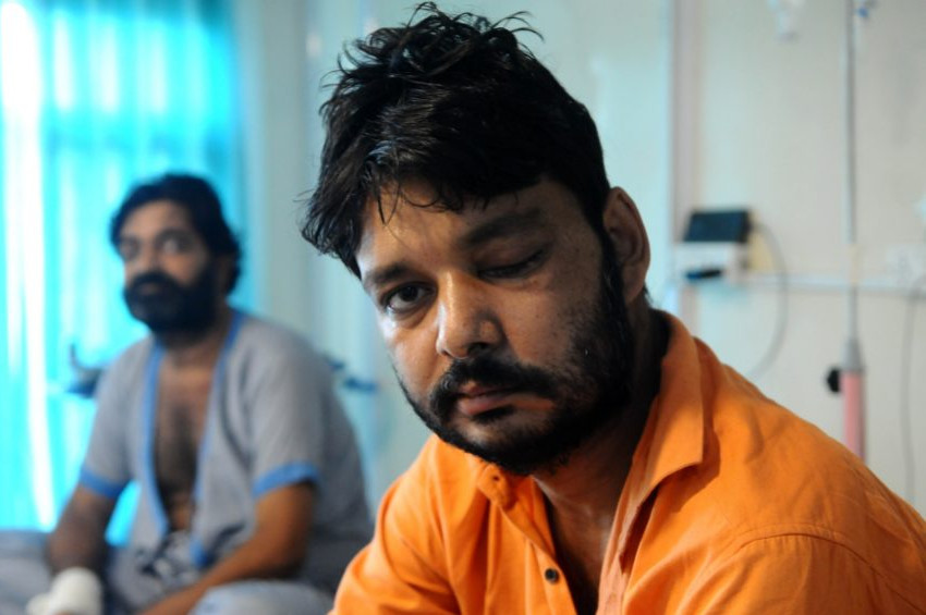 Hindistanda siyah mantar salgını yaygınlaşıyor