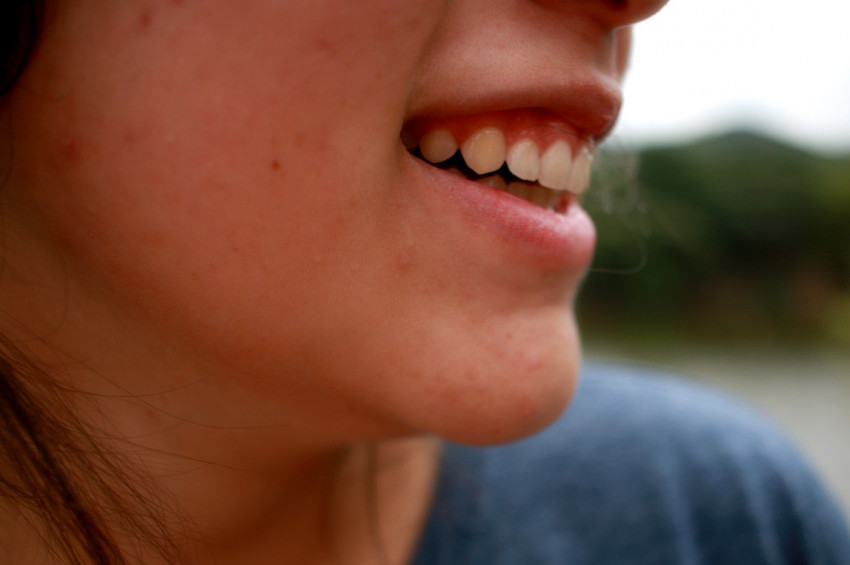 Gençler sivilcelerini saklamak için photoshop kullanıyor!