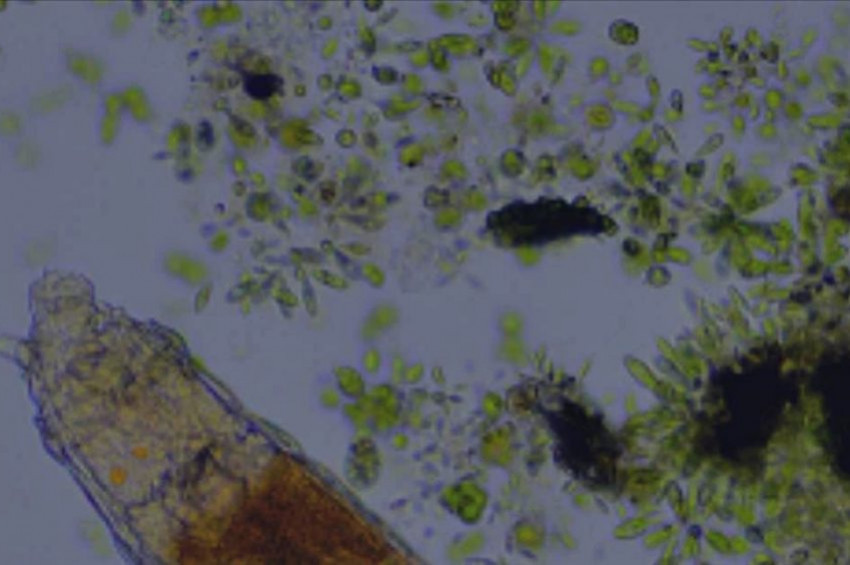 24 bin yıldır ölmeyen mikrop: Bdelloid rotifer
