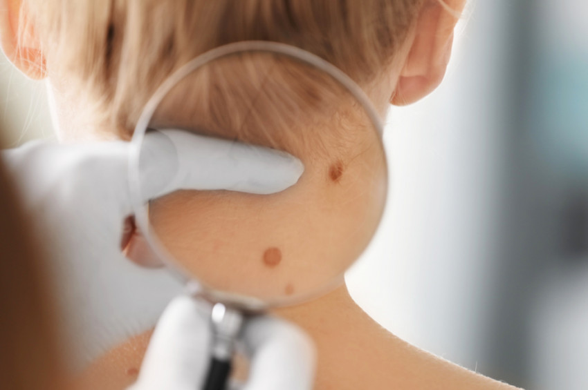 5 aşamada benlerdeki tehlikeyi analiz etme kuralı