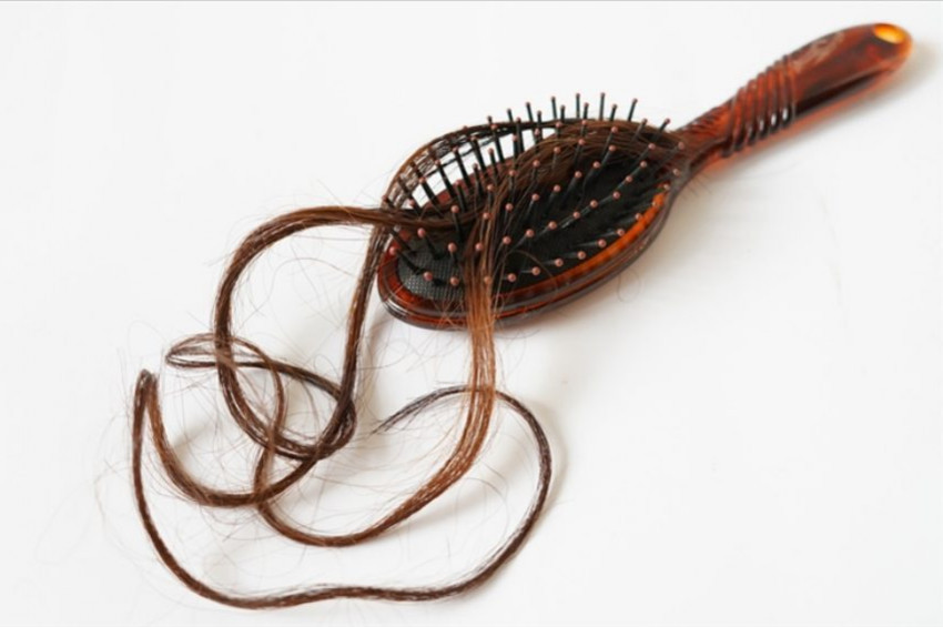 Bir günde kaç tel saç dökülmesi normaldir?