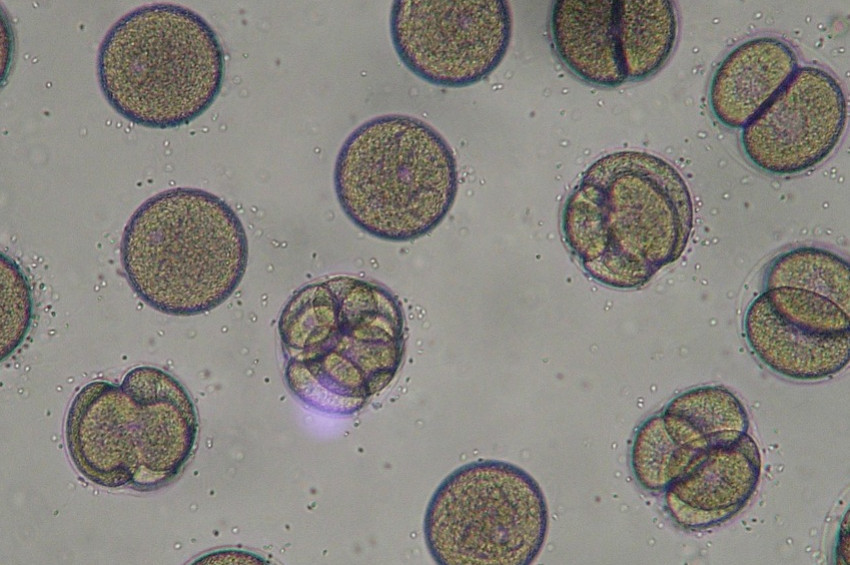 Tatlı suda yaşayan tek hücreli canlı 2 çocuğu öldürdü