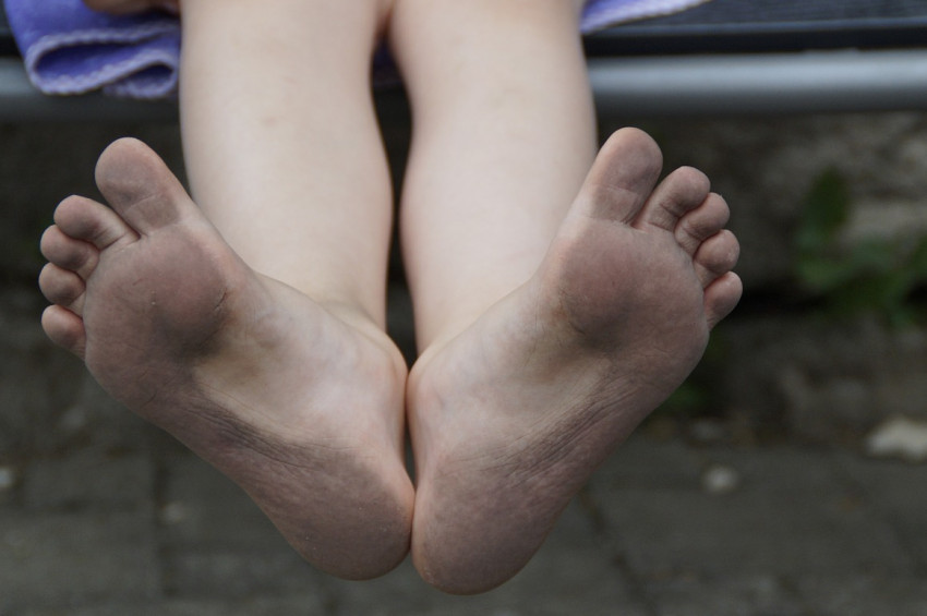 Çocuklarda topuk ağrısı ihmale gelmez