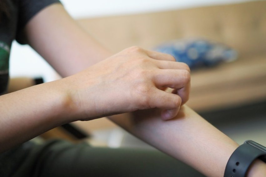 Egzama rahatsızlığı olanlar nasıl beslenmeli, nasıl giyinmeli?