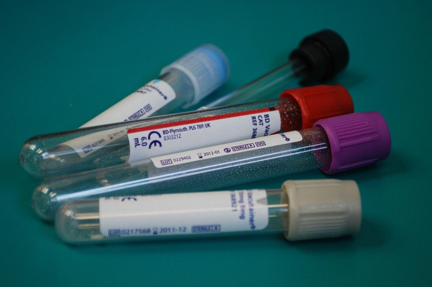 Vücutta demir eksikliğinin 20 belirtisi