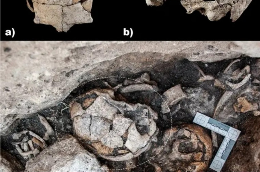 5300 yıl önce kulak ameliyatı yapıldığı ortaya çıktı