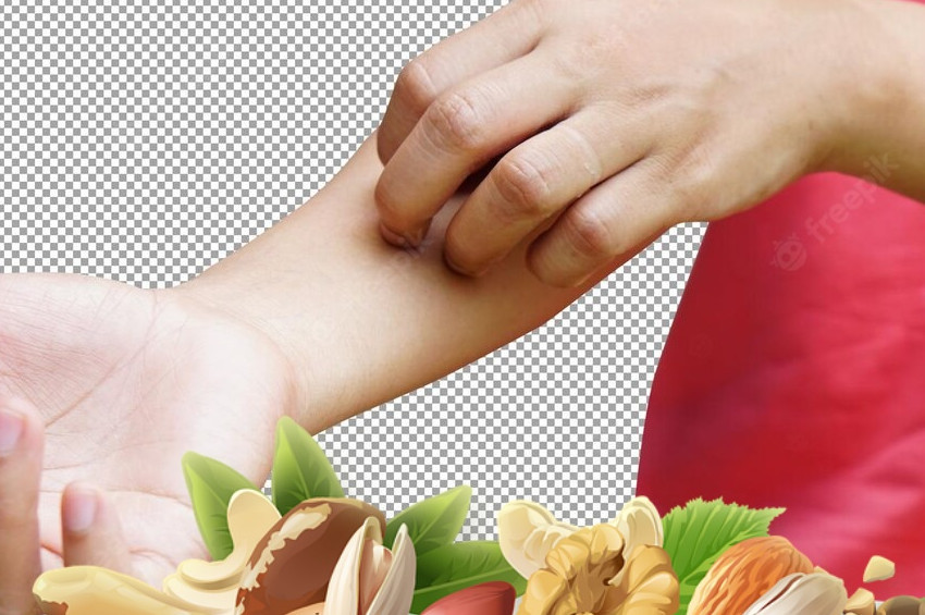 En çok alerji yapan kuruyemişler