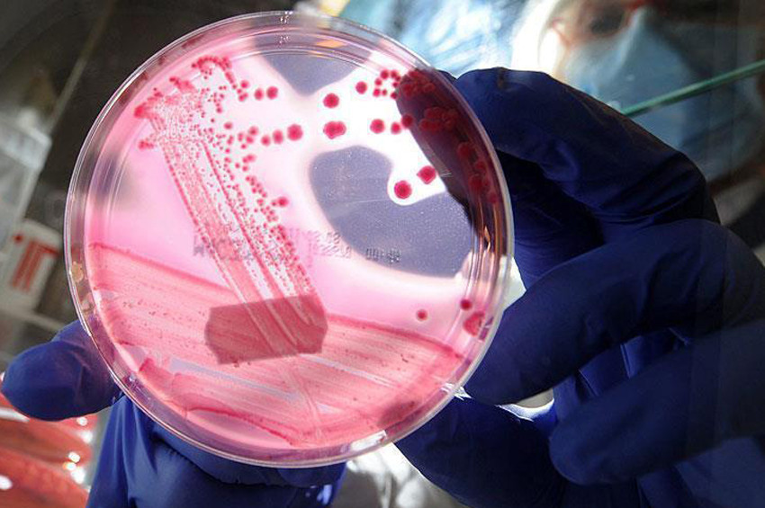 Afrikada kanserin 20 yılda iki kat artması bekleniyor