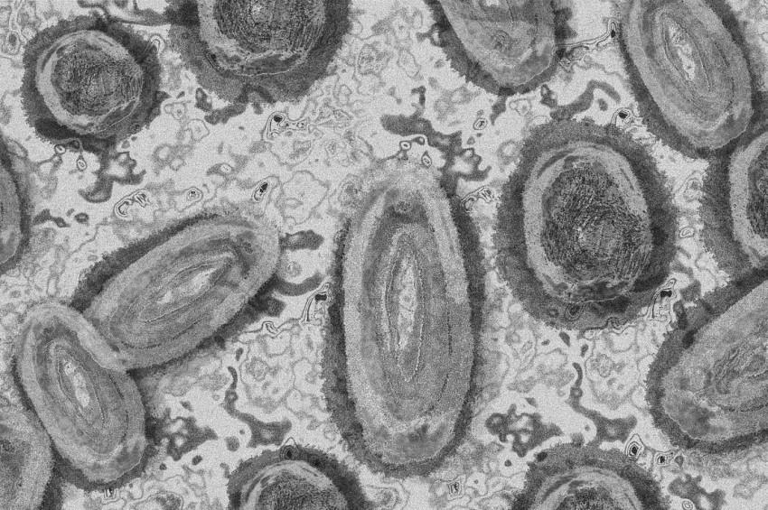 Türkiyede ilk kez maymun çiçeği hastalığı teşhis edildi