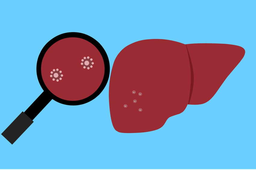 Kan ve cinsellikle bulaşan sarılık türlerine dikkat