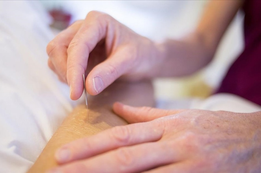 Siyatik ağrıları akupunktur ile azalıyor