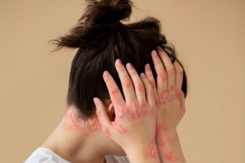 Sıcaktan bunalıp suda serinlemek isterken et yiyen bakterilere yem olmayın!